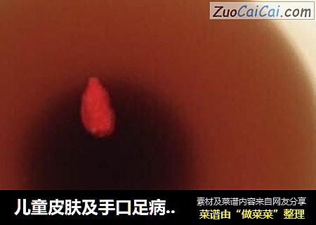 儿童皮肤及手口足病的特效食疗方——乌梅冰糖三豆饮