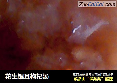 花生银耳枸杞汤