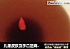 儿童皮肤及手口足病的特效食疗方——乌梅冰糖三豆饮的做法