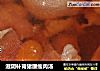 滋阴补肾猪腰瘦肉汤的做法