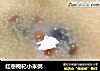 红枣枸杞小米粥的做法