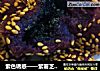 紫色诱惑——紫薯芝麻球的做法